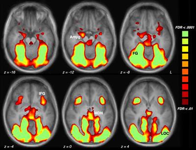 A 5-min paradigm to evoke robust <mark class="highlighted">emotional reactivity</mark> in neuroimaging studies